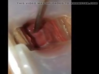 The cervix play: free jepang reged video vid 8d